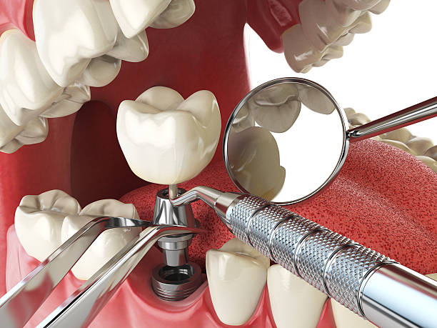 Best Weekend Emergency Dentist in Country Club Estates, GA